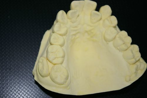 扁平な大臼歯.jpg
